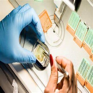 Collecting and testing a sample of abnormal tissue (Biopsy)